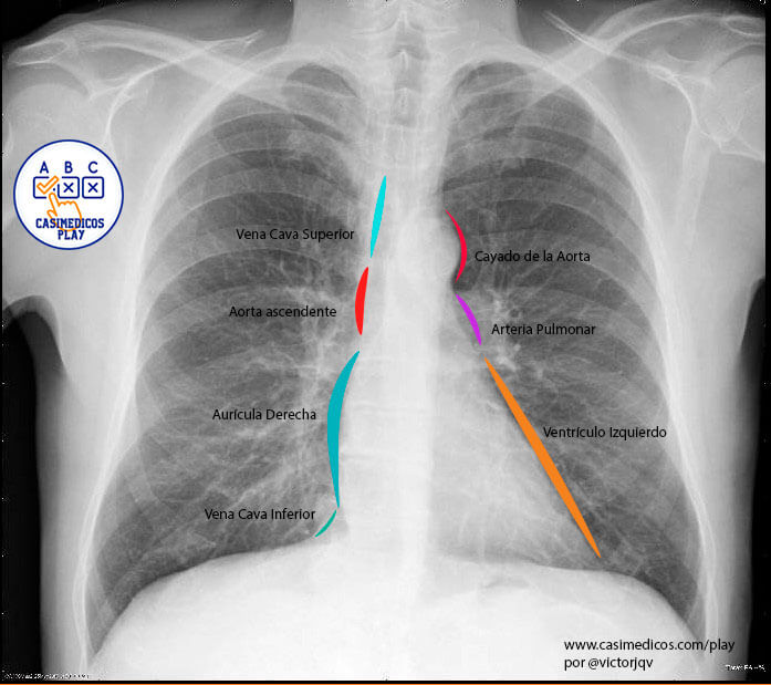 elementos que forman la silueta cardíaca en una Rx de tórax PA