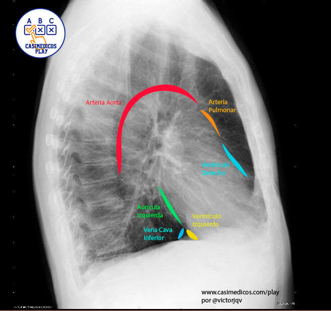 elementos que forman la silueta cardíaca en una Rx de tórax lateral